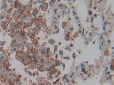 IL-1 alpha Antibody in Immunohistochemistry (Paraffin) (IHC (P))