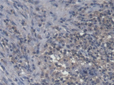 IL-18 Antibody in Immunohistochemistry (Paraffin) (IHC (P))