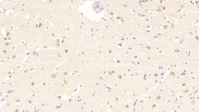 IL-19 Antibody in Immunohistochemistry (Paraffin) (IHC (P))