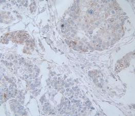 IL-19 Antibody in Immunohistochemistry (Paraffin) (IHC (P))