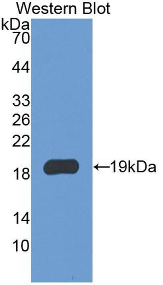 IBA1 Antibody in Western Blot (WB)