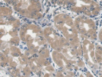 LGALS3BP Antibody in Immunohistochemistry (Paraffin) (IHC (P))