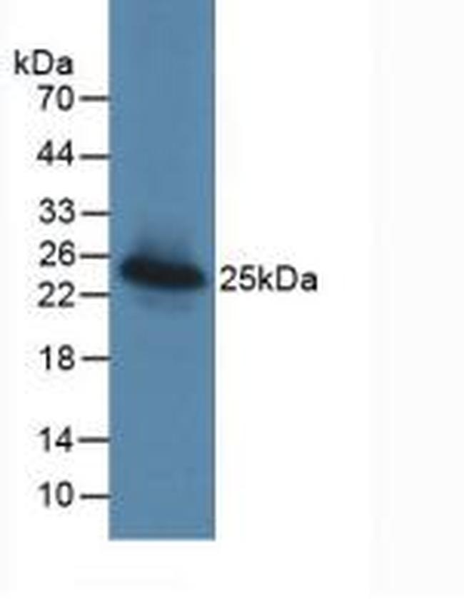 LGALS3BP Antibody in Western Blot (WB)