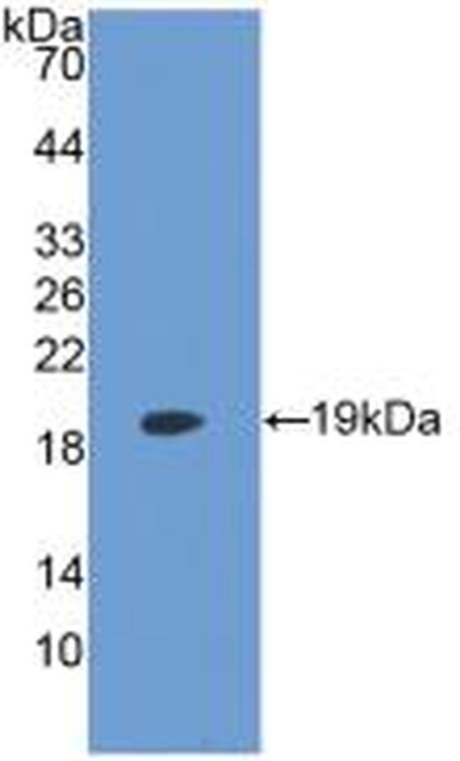 LPCAT3 Antibody in Western Blot (WB)