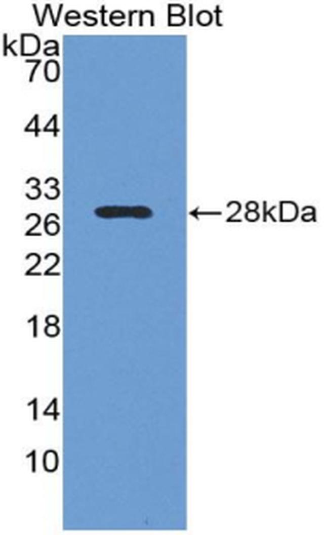 LOXL1 Antibody in Western Blot (WB)