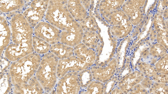 MMP8 Antibody in Immunohistochemistry (Paraffin) (IHC (P))