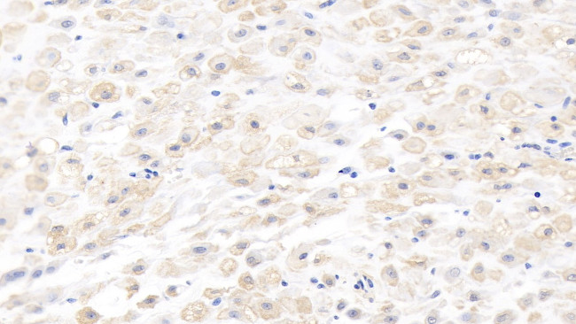 MMP8 Antibody in Immunohistochemistry (Paraffin) (IHC (P))