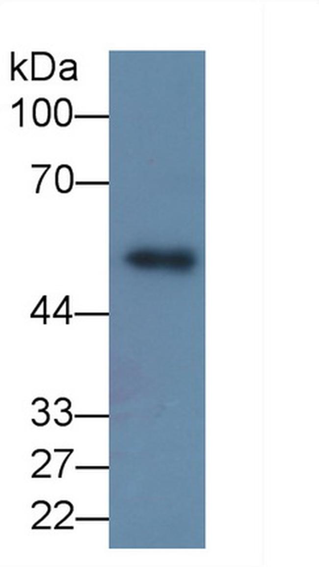 MMP8 Antibody in Western Blot (WB)