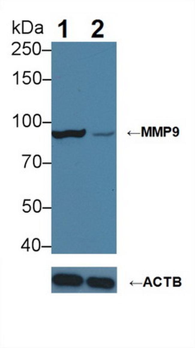 MMP9 Antibody in Western Blot (WB)