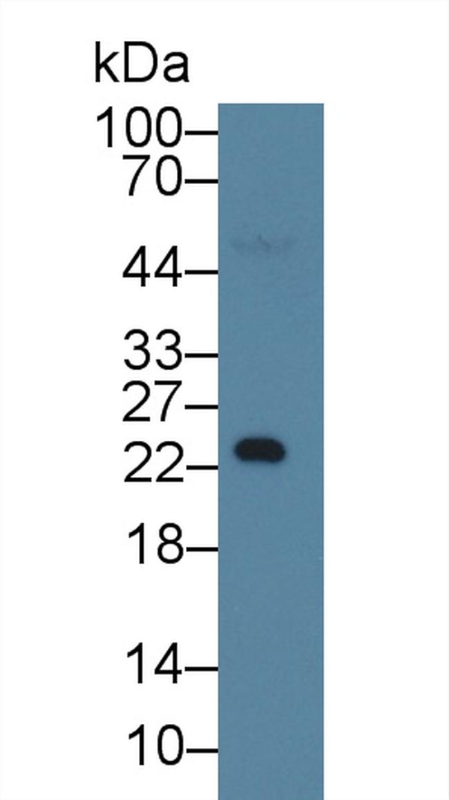 Nephrin Antibody in Western Blot (WB)