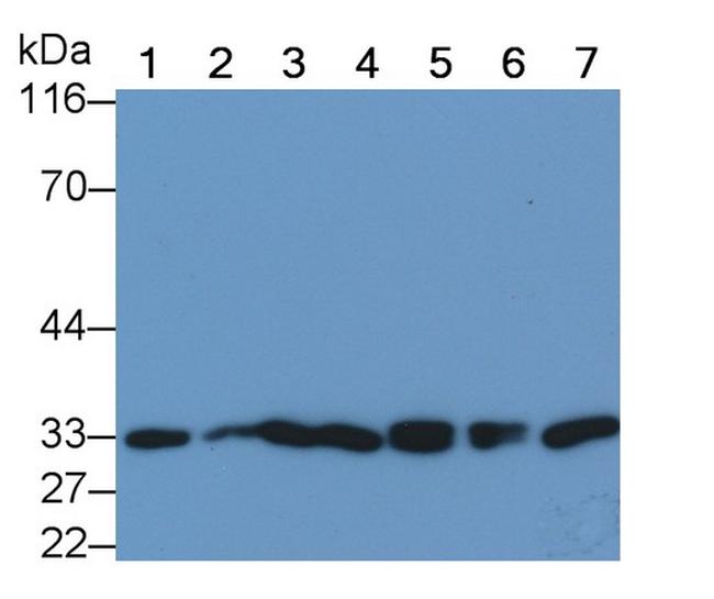 NGF Antibody in Western Blot (WB)