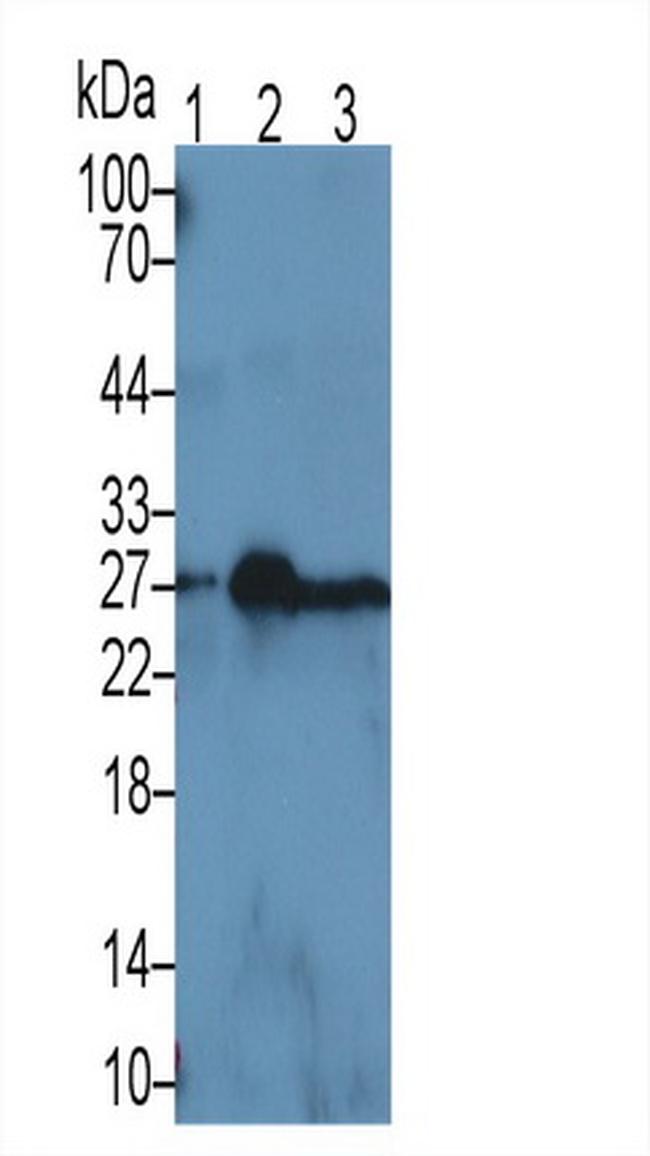 NGAL Antibody in Western Blot (WB)