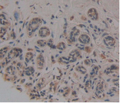 Noggin Antibody in Immunohistochemistry (Paraffin) (IHC (P))