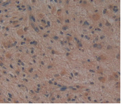 Noggin Antibody in Immunohistochemistry (Paraffin) (IHC (P))