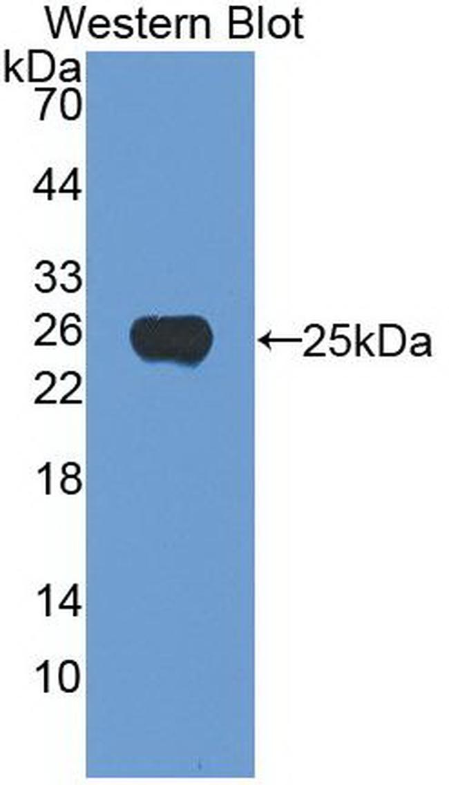 Noggin Antibody in Western Blot (WB)