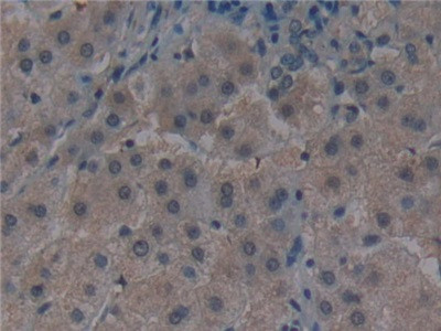 Noggin Antibody in Immunohistochemistry (Paraffin) (IHC (P))