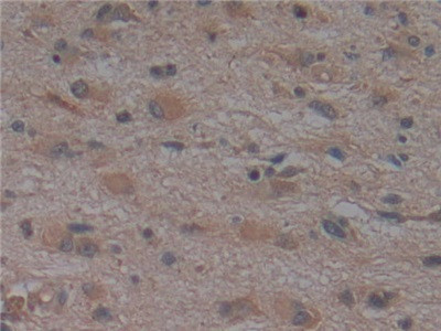 Noggin Antibody in Immunohistochemistry (Paraffin) (IHC (P))