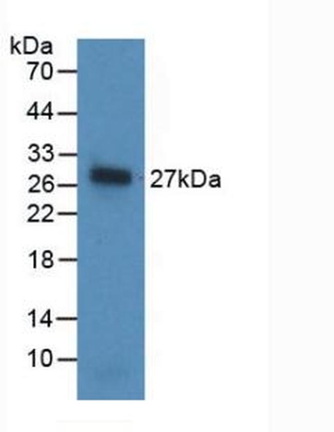 Noggin Antibody in Western Blot (WB)