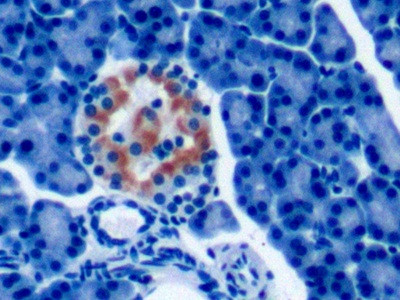 PTHLH Antibody in Immunohistochemistry (Paraffin) (IHC (P))