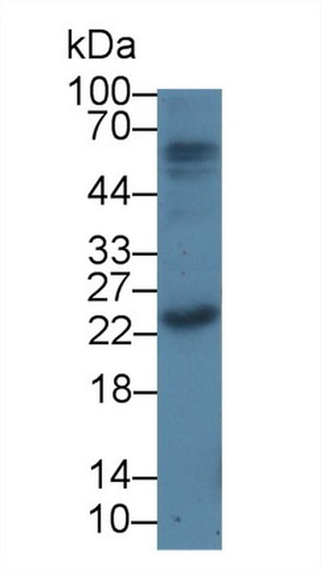 PTHLH Antibody in Western Blot (WB)