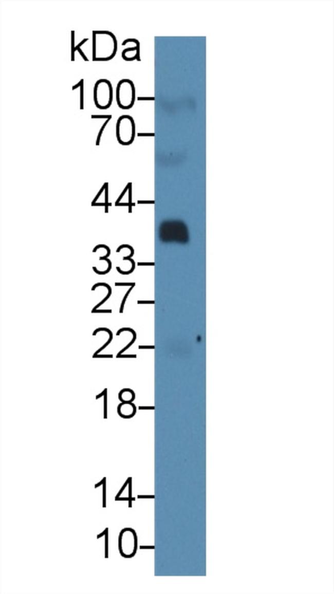 PTHLH Antibody in Western Blot (WB)