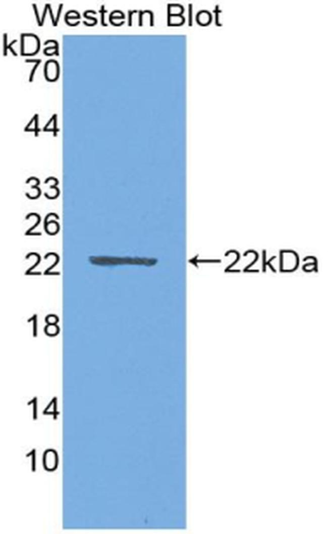 PTHLH Antibody in Western Blot (WB)