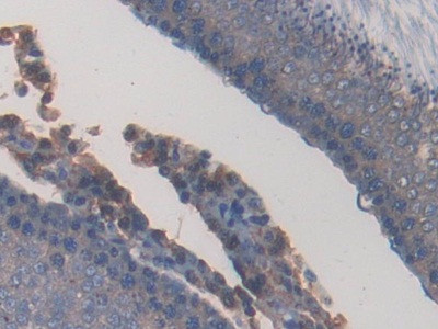 PPAR gamma Antibody in Immunohistochemistry (Paraffin) (IHC (P))