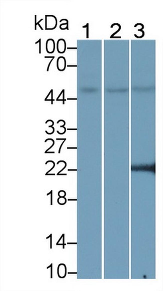 PPAR gamma Antibody in Western Blot (WB)