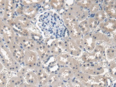 Procollagen I N-Peptide Antibody in Immunohistochemistry (Paraffin) (IHC (P))