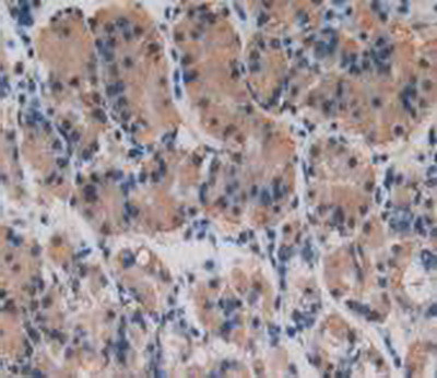 Procollagen I N-Peptide Antibody in Immunohistochemistry (Paraffin) (IHC (P))