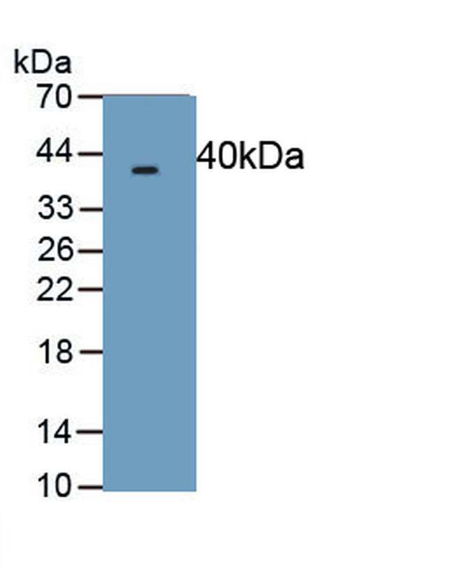 Procollagen I N-Peptide Antibody in Western Blot (WB)