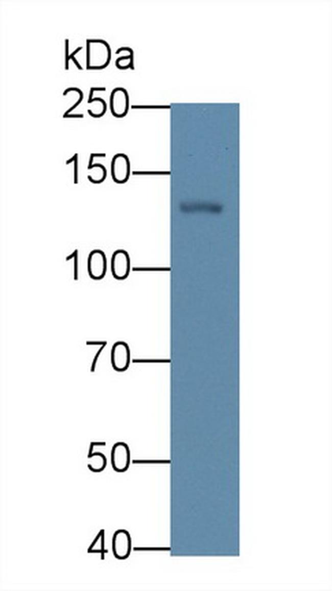 P3NP Antibody in Western Blot (WB)