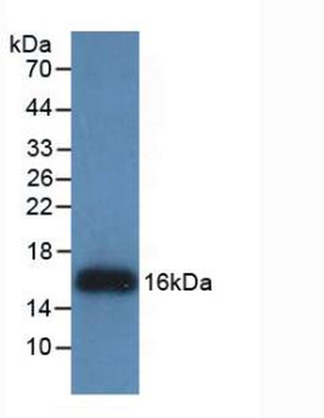 REG3G Antibody in Western Blot (WB)