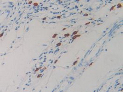 Resistin Antibody in Immunohistochemistry (Paraffin) (IHC (P))