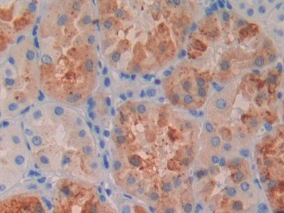 RBP4 Antibody in Immunohistochemistry (Paraffin) (IHC (P))