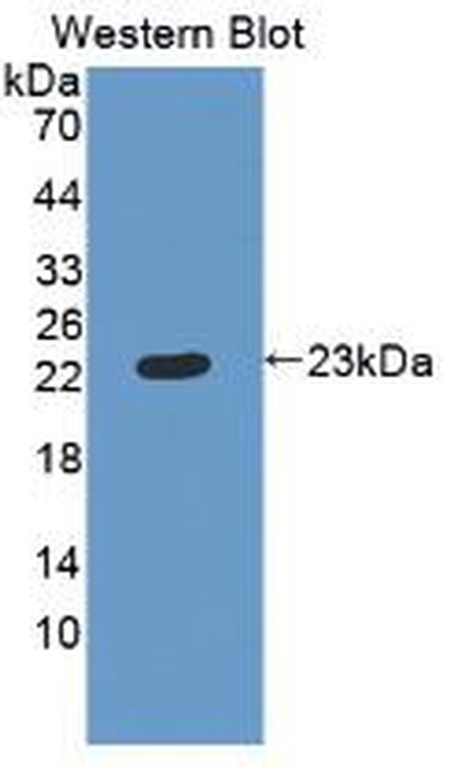 RBP4 Antibody in Western Blot (WB)