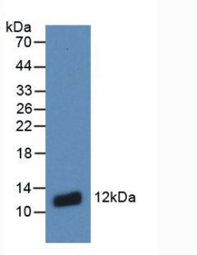 S100A8 Antibody in Western Blot (WB)