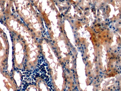 STC1 Antibody in Immunohistochemistry (Paraffin) (IHC (P))