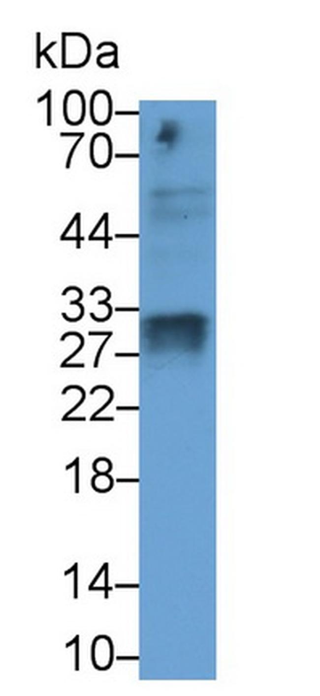 SOD3 Antibody in Western Blot (WB)