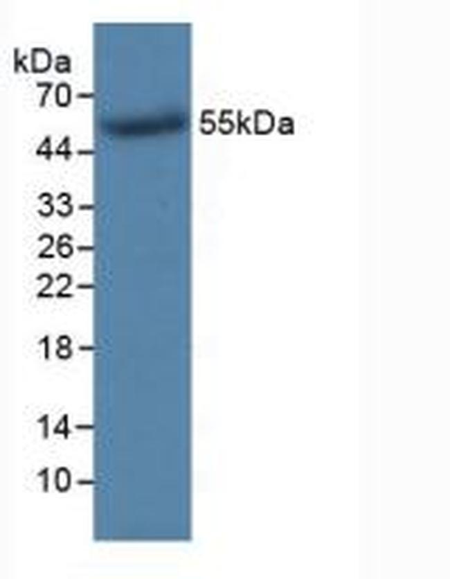 TK1 Antibody in Western Blot (WB)