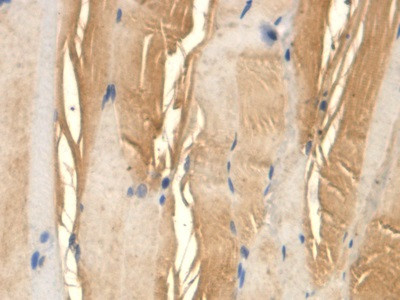 TFPI Antibody in Immunohistochemistry (Paraffin) (IHC (P))