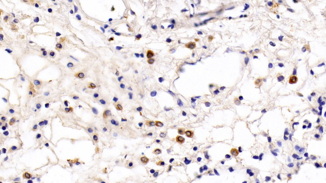 TLR5 Antibody in Immunohistochemistry (Paraffin) (IHC (P))