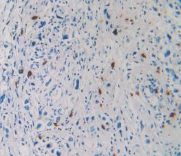 Tryptase Antibody in Immunohistochemistry (Paraffin) (IHC (P))