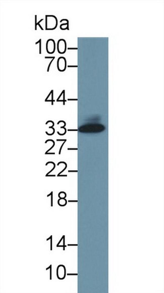 Tryptase Antibody in Western Blot (WB)