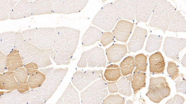 TDO2 Antibody in Immunohistochemistry (Paraffin) (IHC (P))