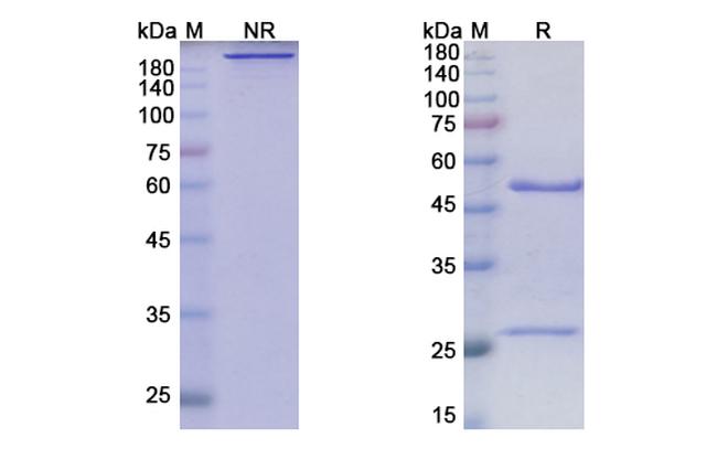 Bevacizumab Humanized Antibody in SDS-PAGE (SDS-PAGE)