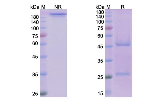 Daclizumab Humanized Antibody in SDS-PAGE (SDS-PAGE)