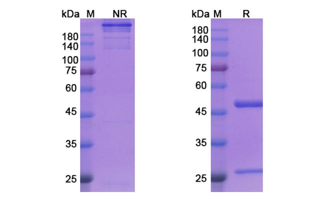 Siplizumab Humanized Antibody in SDS-PAGE (SDS-PAGE)