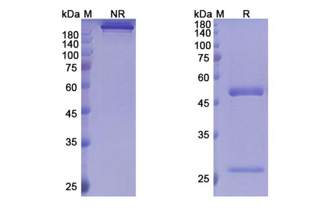 Palivizumab Humanized Antibody in SDS-PAGE (SDS-PAGE)