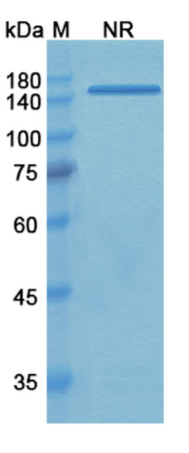 Tadocizumab Humanized Antibody in SDS-PAGE (SDS-PAGE)
